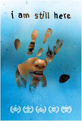 记忆伤痕免费观看